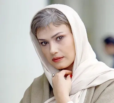 تغییر چهره خانم بازیگر همه را شوکه کرد