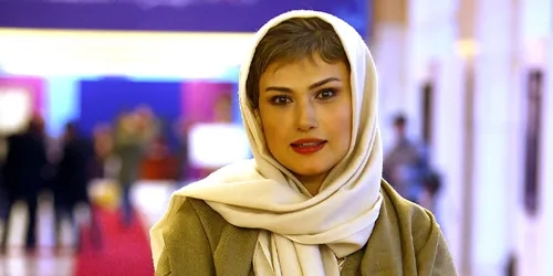 تغییر چهره خانم بازیگر همه را شوکه کرد